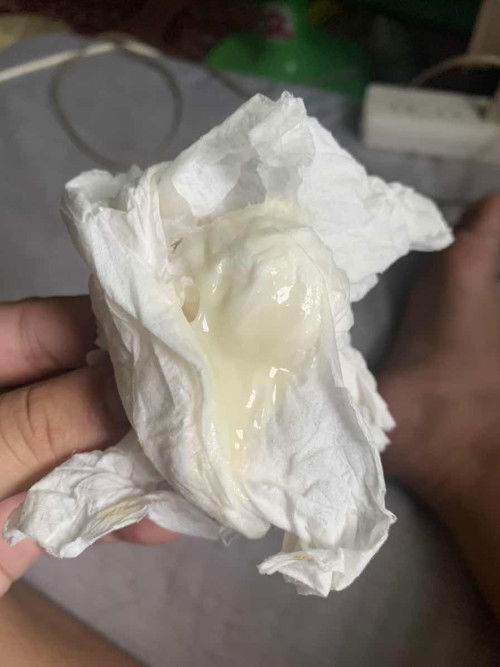 แบบนี้มูกหรือตกขาวคะ