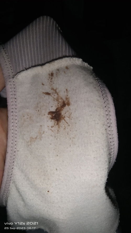 Bund mau tanya..ini lendir darah mau tanda lahiran g sih