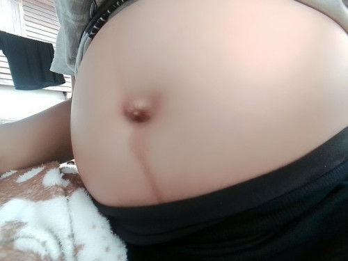 สะดือแบบนี้หญิงหรือชายคะ