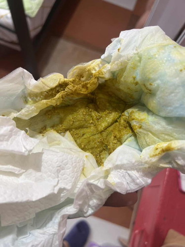 *PASINTABI PO: My LOs poop looks like this. Normal po ba in a formula fed baby? 😔
