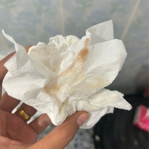 39+1 แม่ๆถ้ามีมูกแบบนี้คือใกล้คลอดรึยังคะ?