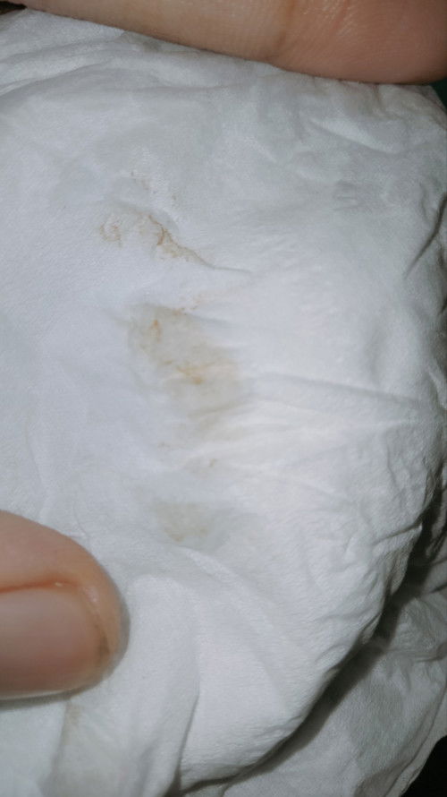 Usia kandungan 9minggu