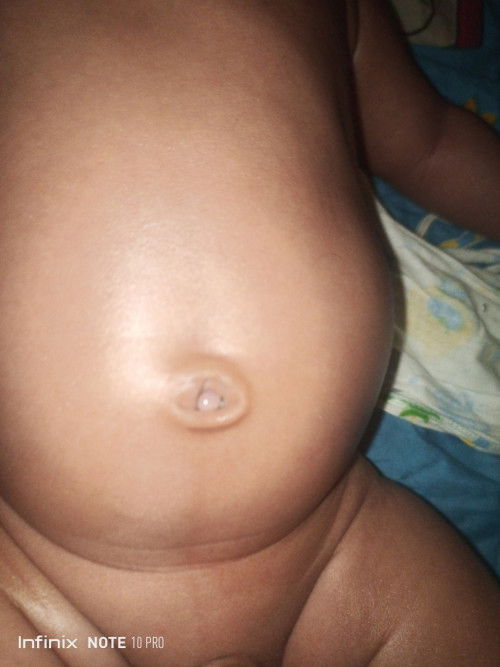 Pusar Basah dan ada daging kecil