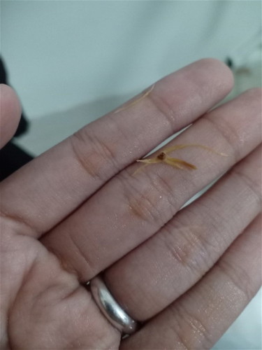 pag cr ko po kagabi nung mag huhugas nako nakapa ko po yung sinulid nakatanggal na po