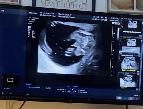 Ano po kaya ang gender ni baby?