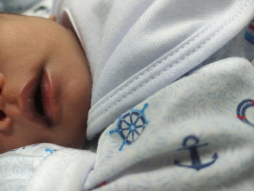 Normal po ba ang pagiiba ng kulay ng inner lips ni baby?