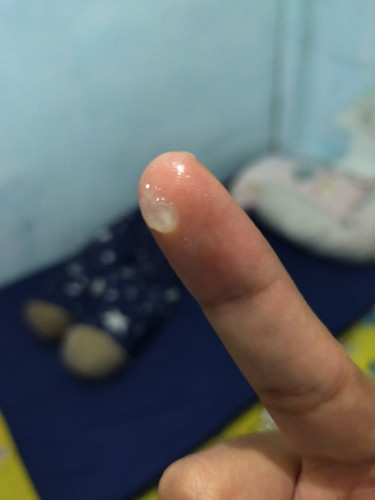 ขอขอบคุณล่วงหน้า