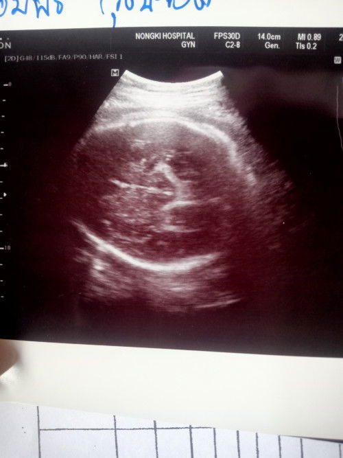 มีใครพอดูออกบ้างคะ