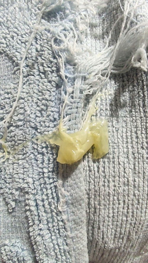 Lendir Keputihan Kental