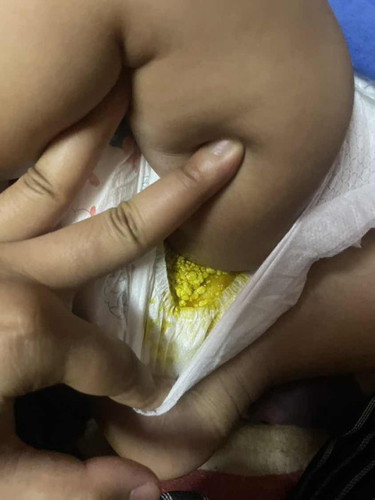 Anak berak kuning lendir