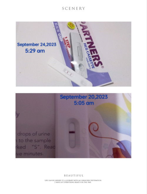 I have a question po. I am 6 weeks pregnant with no pregnancy symptoms .Is that normal po?