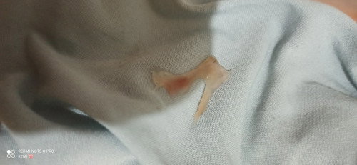 First time mom is this mucus plug?