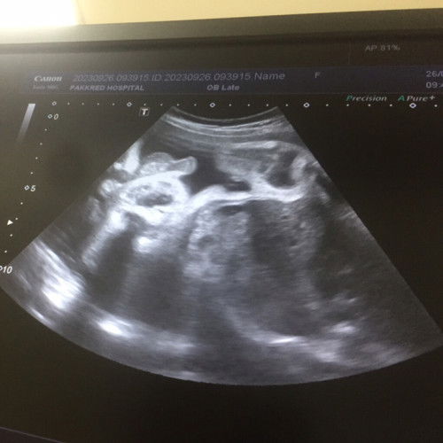 ผู้ชายใช่มั้ยค่ะในรูป❤️🙏🏻