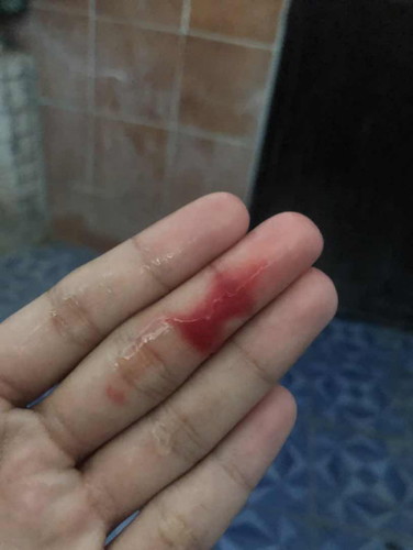 เลือดออกช่องคลอด