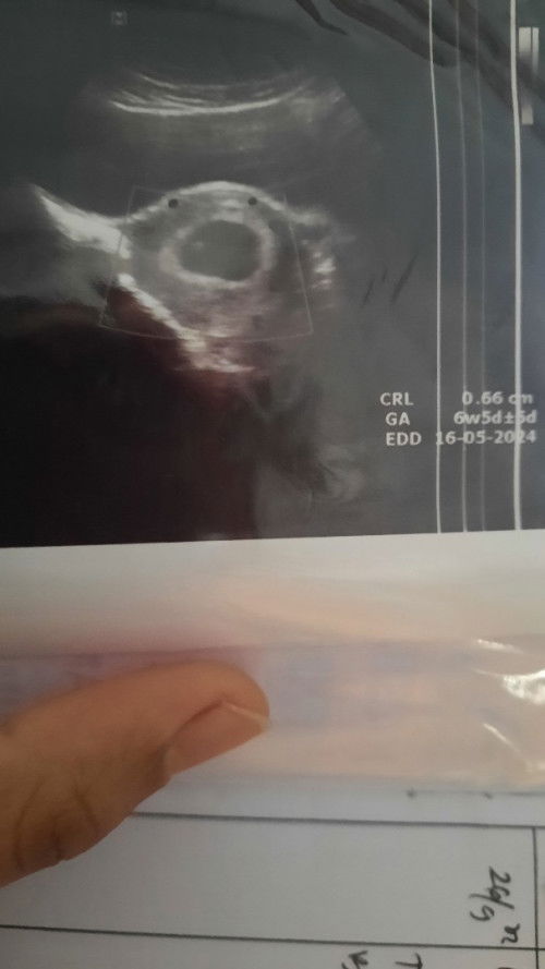 Terlihat janin tapi belum ada djj