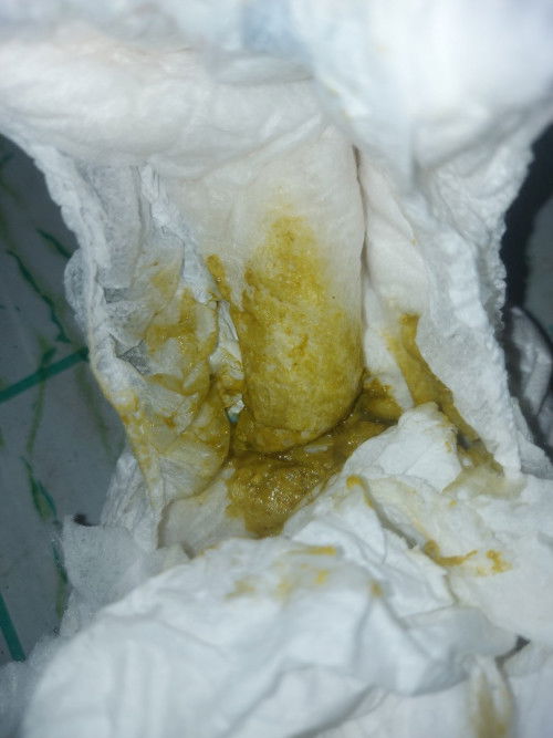 Bayi 2 bulan setgh pup hijau