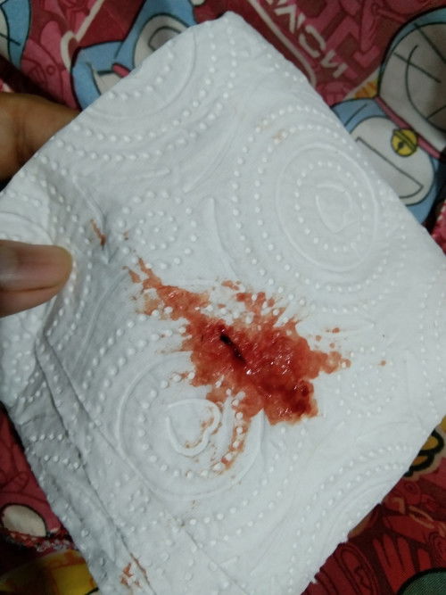 หลังคลอดกี่เดือนน้ำคาวปลาหมด