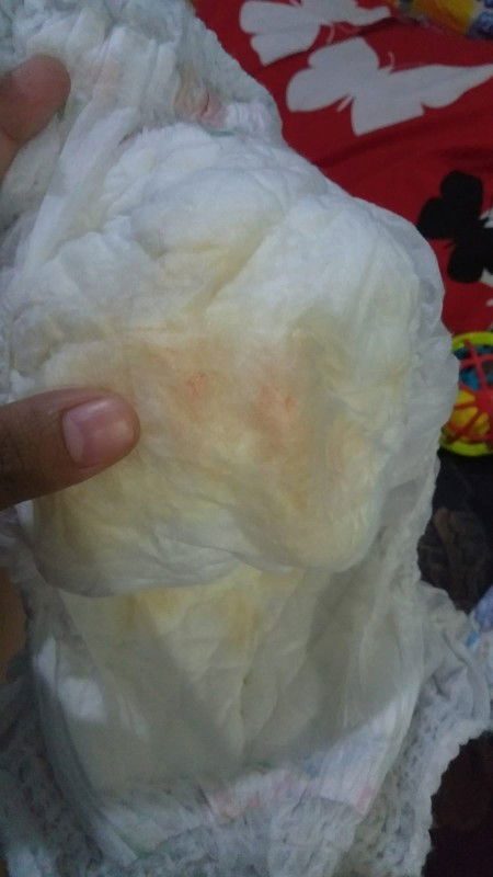 Bercak merah pada diapers