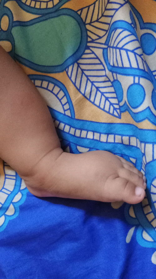 Kaki bayi usia 4 bulan