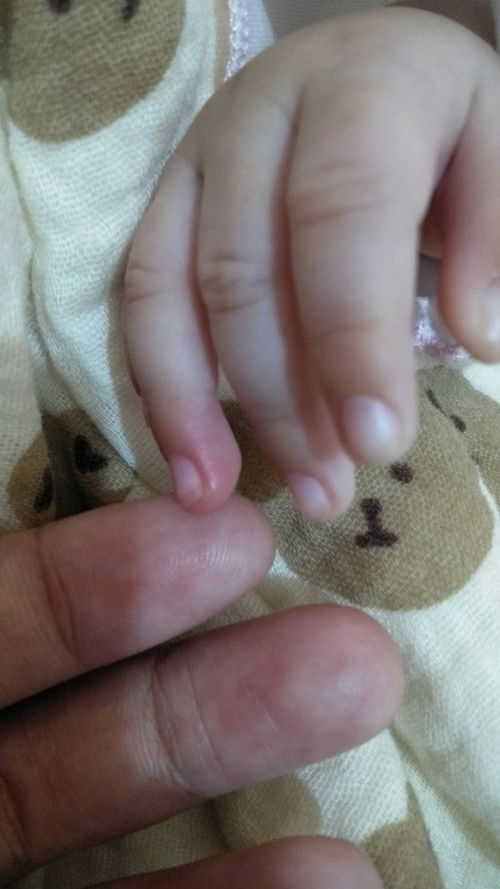 CANTENGAN KUKU TANGAN BAYI