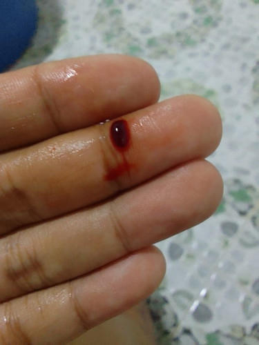 เลือดออกแบบนี้อันตรายมัยคะ
