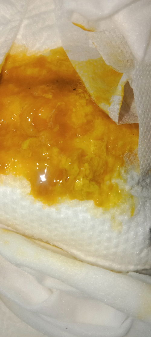 Berak baby baru 2 bulan 30 hari