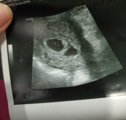 2 kantong, 1 lebih kecil.