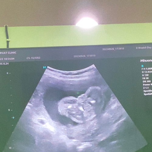 แม่ๆพอดูออกไม่คะว่าผู้หญิงหรือผู้ชาย หมอ