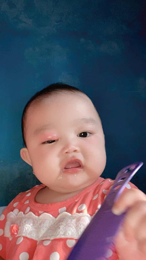 Bintitan bayi