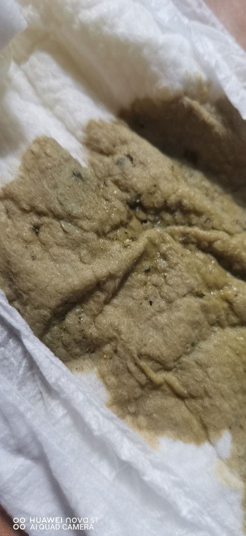 sensitive photo ⚠️