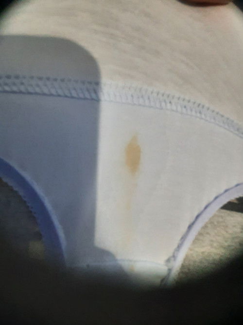 รบกวนสอบถามค่ะ ตอนนี้กังวลมากเลยค่ะ