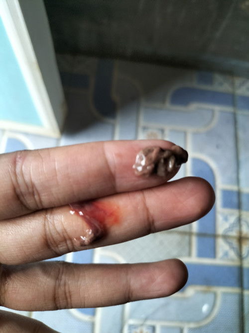 Keluar lendir dan darah