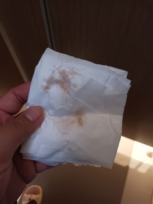 สอบถามแม่ๆหน่อยคะแบบนี้ต้องกลับไปหาหมอมัย