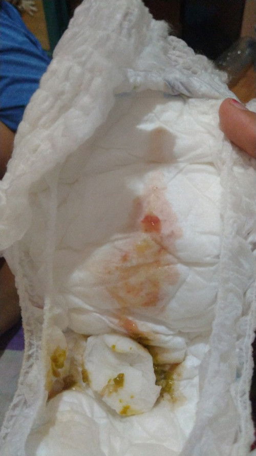 Bab bayi 6 jalan 7 bulan