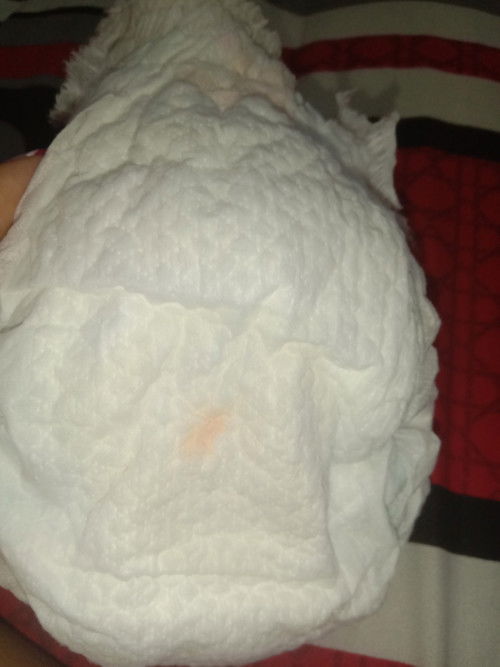 Bercak kemerahan di popok