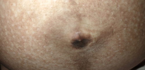 35+6week มีตุ้มที่สะดือ