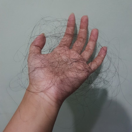 RAMBUT RONTOK