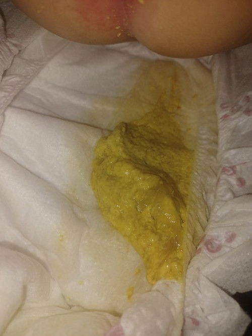 Hello po mga mami. Pasintabi po sa kumakain.