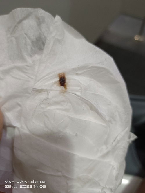 ท้อง8 สัปดาห์3วัน มีแบบนี้ออกมาค่ะ