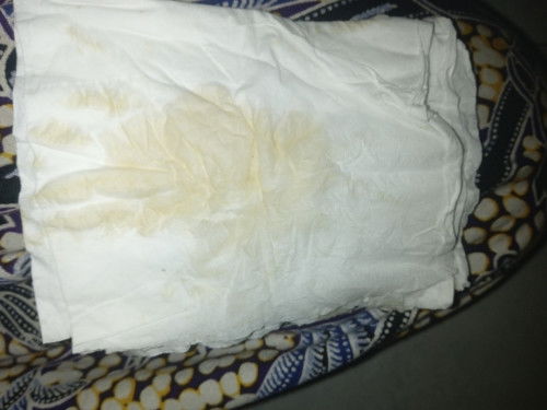 UK 30 minggu, setelah berhubungan intim tiba2 keluar cairan trasa sperti haid, flek