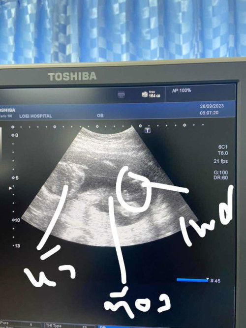 แม่ๆช่วยดูหน่อยนะคะว่า ช 100% รึเปล่า