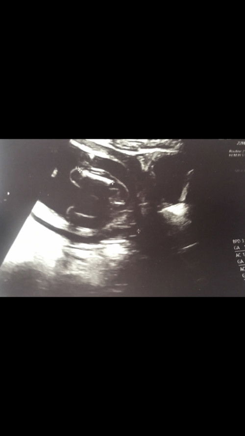 รบกวนแม่ๆช่วยมองหน่อยค่ะ ว่าน้องมีโอกาสเป็นผู้หญิงหรือผู้ชายคะ