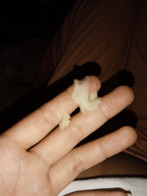 เป็นแบบนี้ตั้งแต่เมื่อวานเย็นจนวันนี้ทั้งวันจะเป็นอะไรไหมคะ เป็นทีเป็นเยอะค่ะ