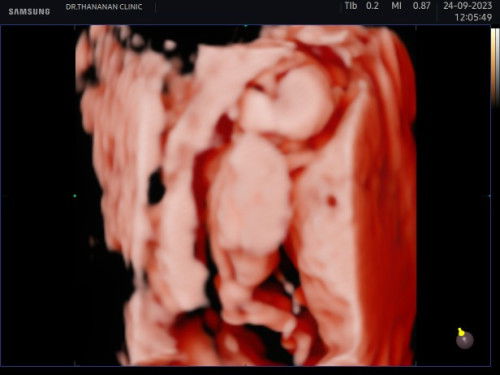 ภาพ 4 มิติ 15 วีค 2 วัน