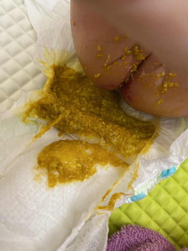 BABY ASYIK BERAK SEHARI BERKALI KALI