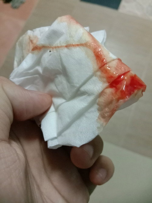 น้ำคาวปลาหลังคลอด
