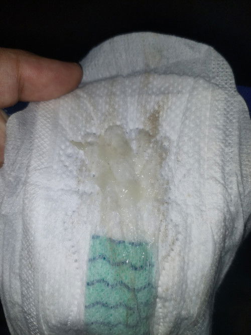 Keluar lendir 39w 5d