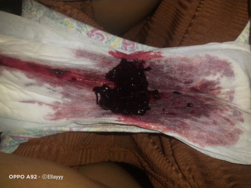 Normal lang po ba to?