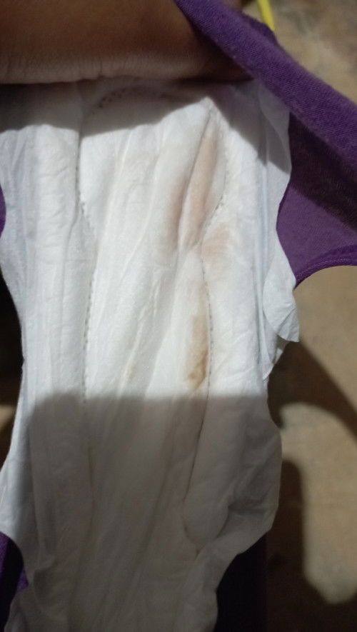 Muncul flek setelah berhubungan