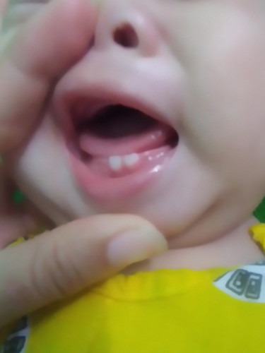 S con e rag moc ở ngoai nu z Mn. K giog cac be khac. Z có s k ak